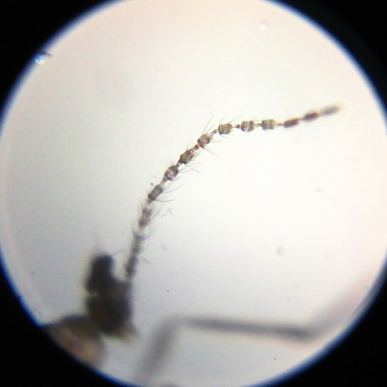Увеличение 160x . Усик (орган обоняния) насекомого. Школьный микроскоп Алиэкспресс